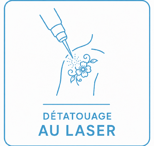 Détatouage par laser