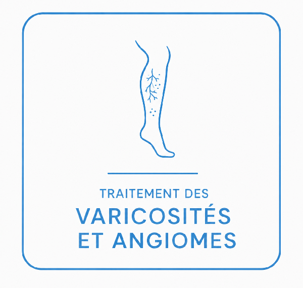 Traitements des varicosités et angiomes